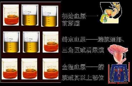 剧烈运动后下面流血了怎么回事:警惕可能的原因