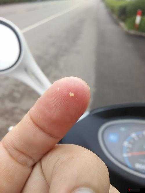 双腿间硬硬的胎头湿漉漉的挤出来，遇到这种情况怎么办？