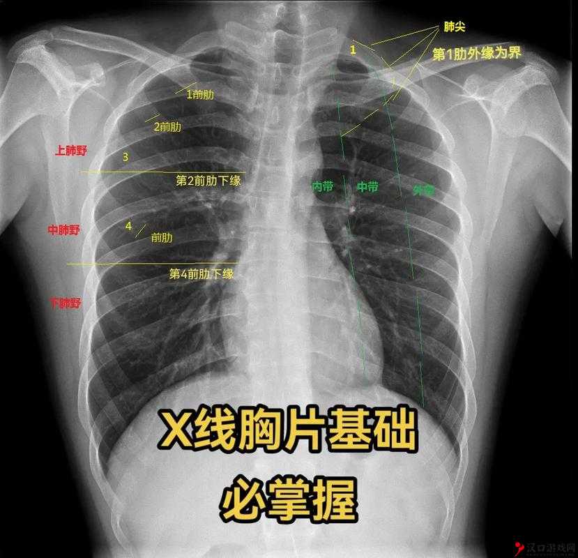 100%胸片曝光率软件可以直接看:提升医疗影像诊断效率的利器