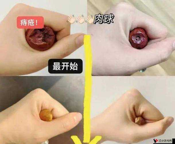 肛门一张一缩,是痔疮吗?