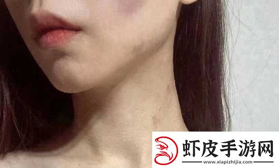 红雅典娜LIYA死了吗