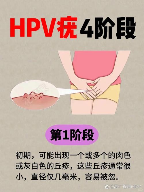 女人热潮时一夹一夹会得HPV吗