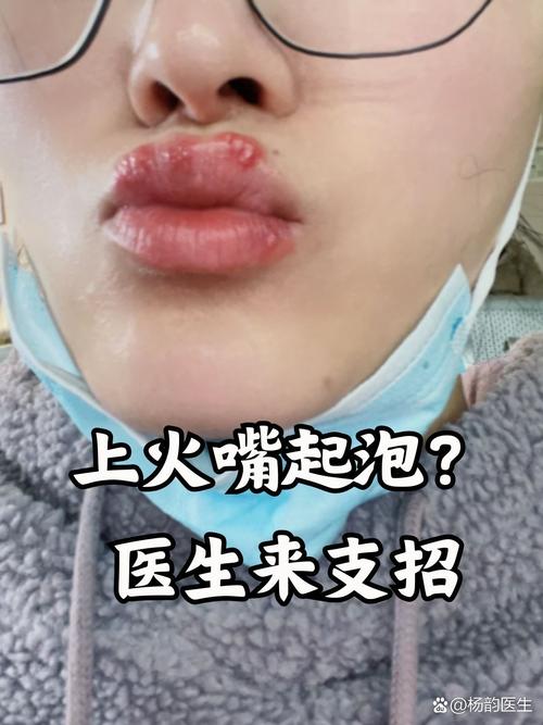 妈妈用嘴巴帮我消火视频